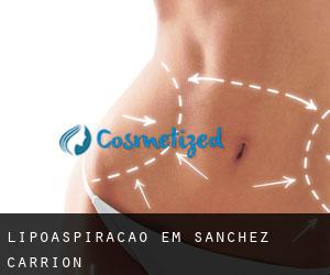 Lipoaspiração em Sanchez Carrion