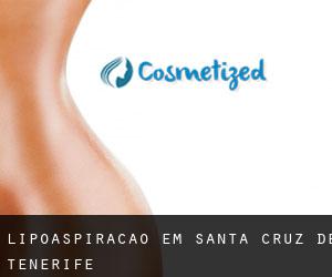 Lipoaspiração em Santa Cruz de Tenerife