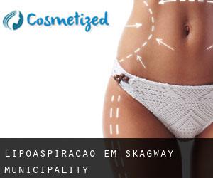 Lipoaspiração em Skagway Municipality Lipoaspiração em Skagway Municipality