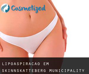 Lipoaspiração em Skinnskatteberg Municipality