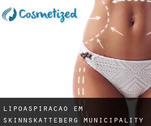 Lipoaspiração em Skinnskatteberg Municipality