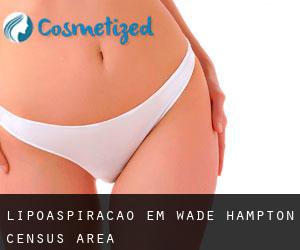 Lipoaspiração em Wade Hampton Census Area Lipoaspiração em Wade Hampton Census Area