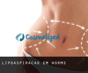 Lipoaspiração em Worms Lipoaspiração em Worms
