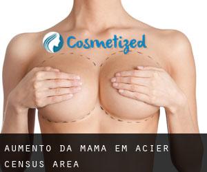 Aumento da mama em Acier (census area)