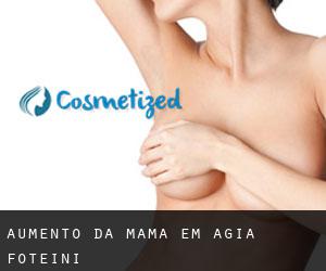 Aumento da mama em Agía Foteiní