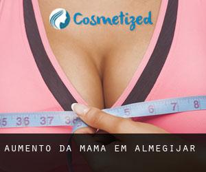 Aumento da mama em Almegíjar
