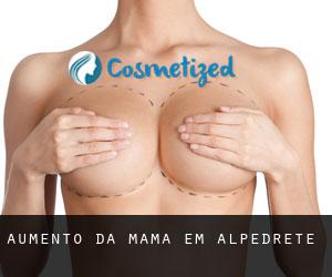 Aumento da mama em Alpedrete