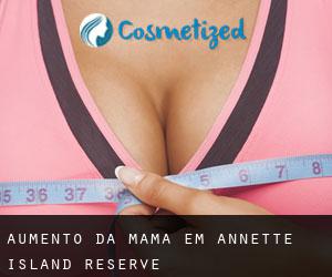Aumento da mama em Annette Island Reserve
