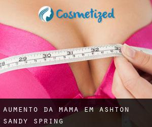Aumento da mama em Ashton-Sandy Spring