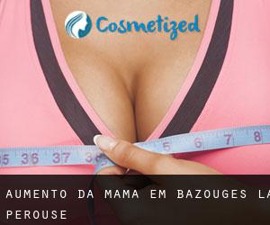 Aumento da mama em Bazouges-la-Pérouse