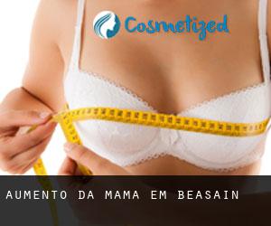 Aumento da mama em Beasain Aumento da mama em Beasain