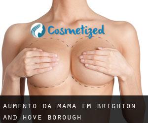 Aumento da mama em Brighton and Hove (Borough)