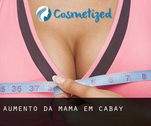 Aumento da mama em Cabay