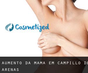 Aumento da mama em Campillo de Arenas