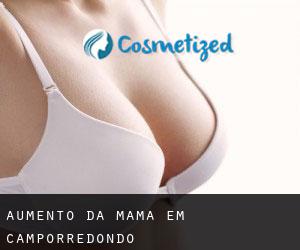 Aumento da mama em Camporredondo