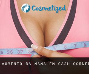 Aumento da mama em Cash Corner