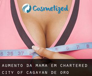 Aumento da mama em Chartered City of Cagayan de Oro