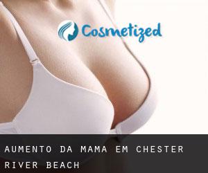 Aumento da mama em Chester River Beach
