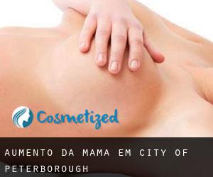 Aumento da mama em City of Peterborough