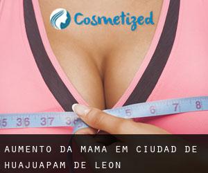 Aumento da mama em Ciudad de Huajuapam de León