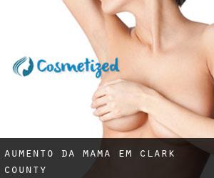 Aumento da mama em Clark County