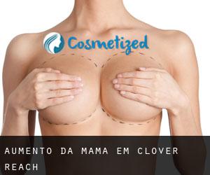 Aumento da mama em Clover Reach