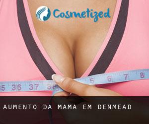 Aumento da mama em Denmead