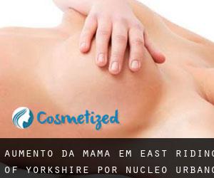 Aumento da mama em East Riding of Yorkshire por núcleo urbano - página 1