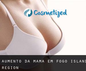 Aumento da mama em Fogo Island Region