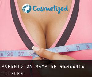 Aumento da mama em Gemeente Tilburg