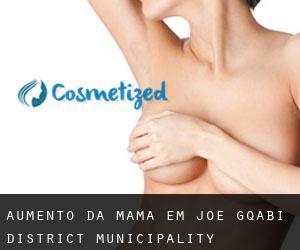 Aumento da mama em Joe Gqabi District Municipality
