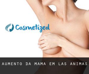 Aumento da mama em Las Animas