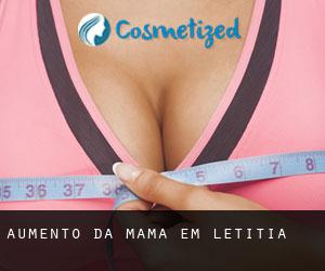 Aumento da mama em Letitia