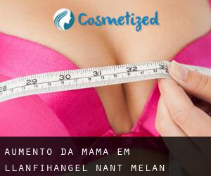 Aumento da mama em Llanfihangel-nant-Melan