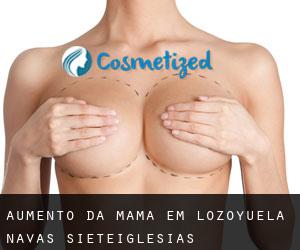 Aumento da mama em Lozoyuela-Navas-Sieteiglesias