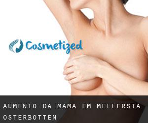 Aumento da mama em Mellersta Österbotten
