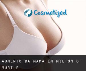 Aumento da mama em Milton of Murtle Aumento da mama em Milton of Murtle
