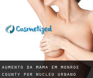 Aumento da mama em Monroe County por núcleo urbano - página 1