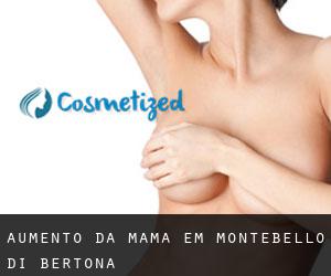Aumento da mama em Montebello di Bertona
