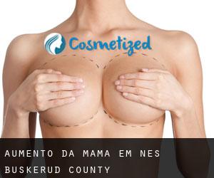 Aumento da mama em Nes (Buskerud county)
