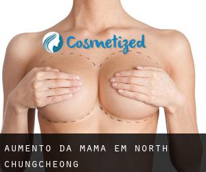 Aumento da mama em North Chungcheong