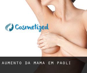 Aumento da mama em Paoli