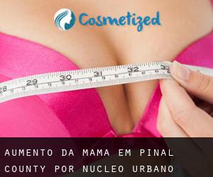Aumento da mama em Pinal County por núcleo urbano - página 1