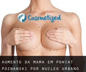 Aumento da mama em Powiat poznański por núcleo urbano - página 1