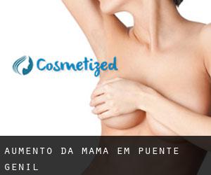 Aumento da mama em Puente-Genil