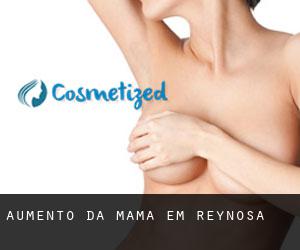 Aumento da mama em Reynosa