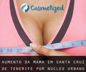 Aumento da mama em Santa Cruz de Tenerife por núcleo urbano - página 1
