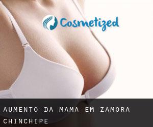 Aumento da mama em Zamora-Chinchipe