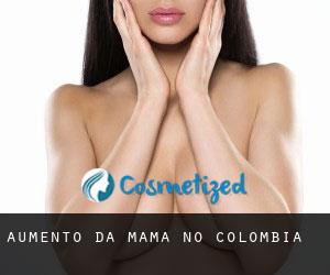 Aumento da mama no Colômbia