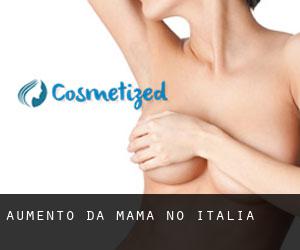 Aumento da mama no Itália